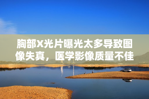 胸部X光片曝光太多导致图像失真，医学影像质量不佳